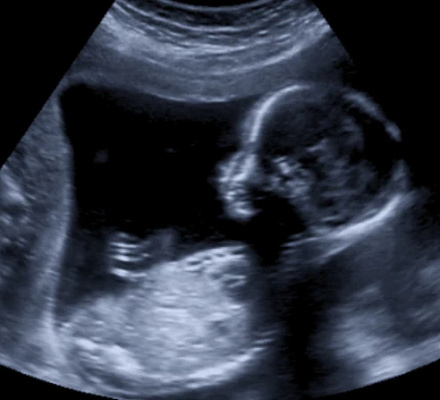 Предложение о голосовании за аборт в Вирджинии продвигается